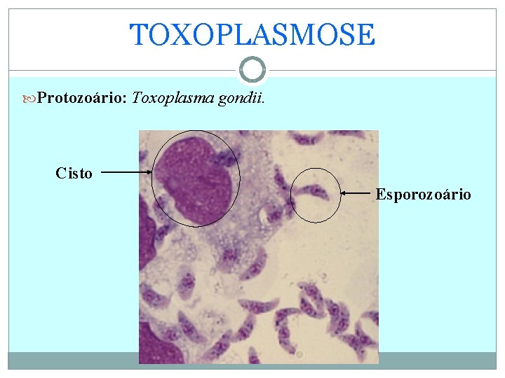 TOXOPLASMOSE Protozoário: Toxoplasma gondii. Cisto Esporozoário 
