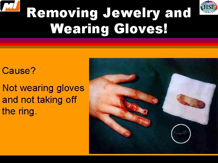 Removing Jewelry and Wearing Gloves! Cause? Not wearing gloves and not taking off the