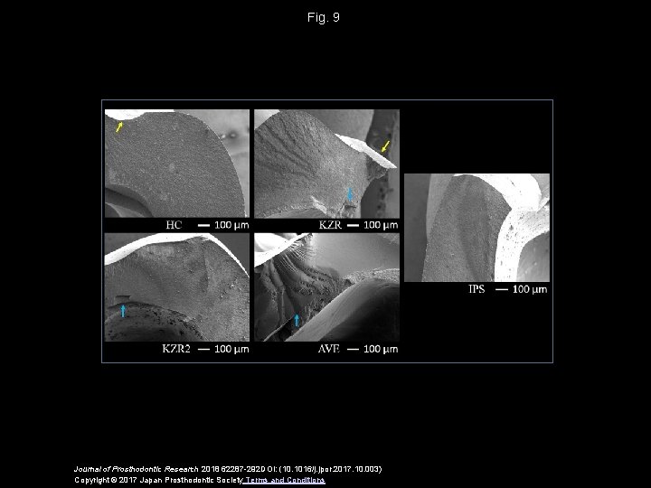 Fig. 9 Journal of Prosthodontic Research 2018 62287 -292 DOI: (10. 1016/j. jpor. 2017.