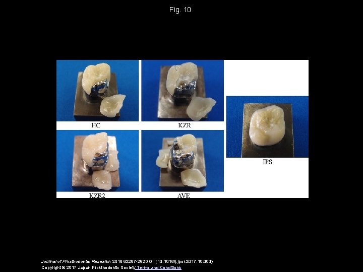 Fig. 10 Journal of Prosthodontic Research 2018 62287 -292 DOI: (10. 1016/j. jpor. 2017.