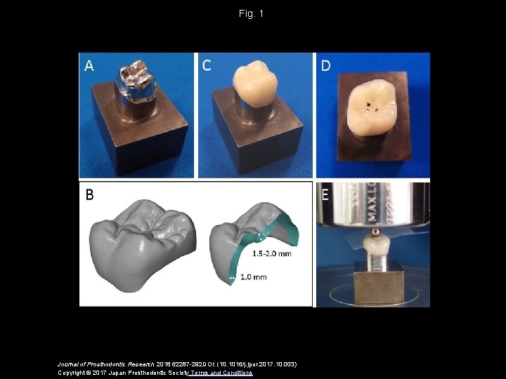 Fig. 1 Journal of Prosthodontic Research 2018 62287 -292 DOI: (10. 1016/j. jpor. 2017.