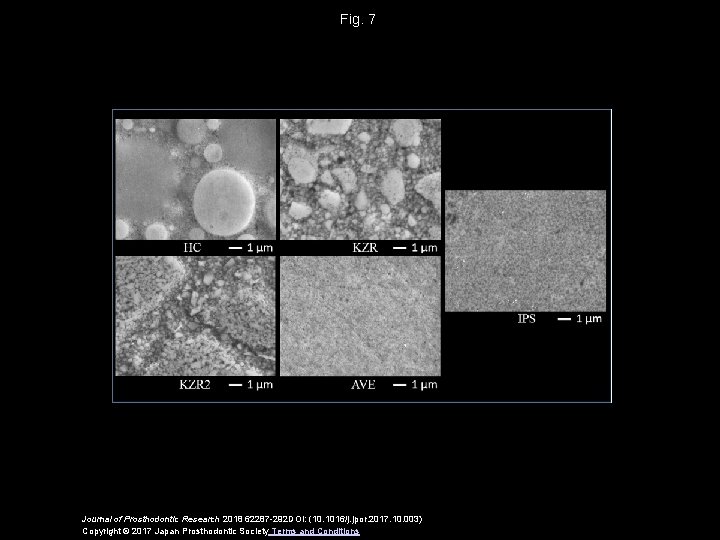 Fig. 7 Journal of Prosthodontic Research 2018 62287 -292 DOI: (10. 1016/j. jpor. 2017.