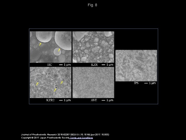 Fig. 8 Journal of Prosthodontic Research 2018 62287 -292 DOI: (10. 1016/j. jpor. 2017.