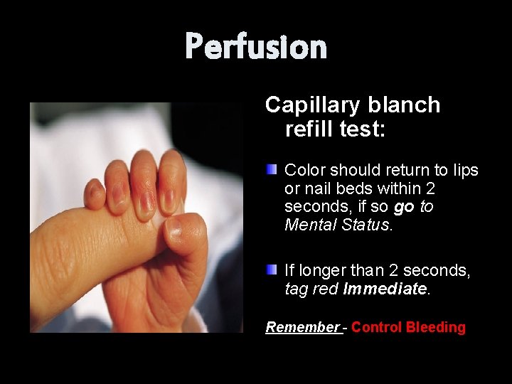 Perfusion Capillary blanch refill test: Color should return to lips or nail beds within