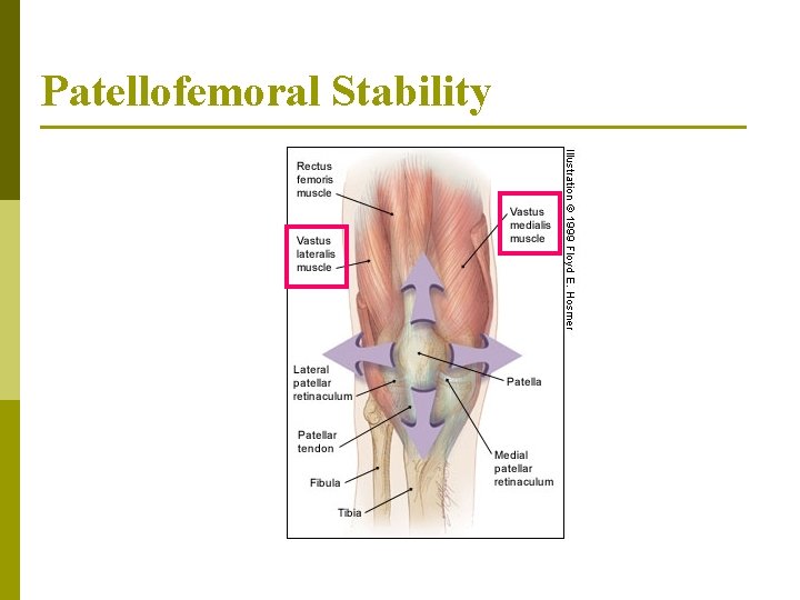 Patellofemoral Stability 