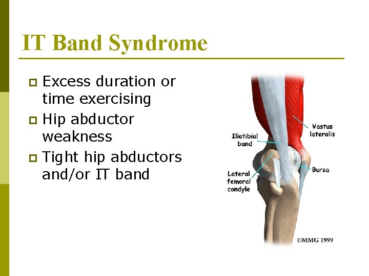 IT Band Syndrome Excess duration or time exercising p Hip abductor weakness p Tight