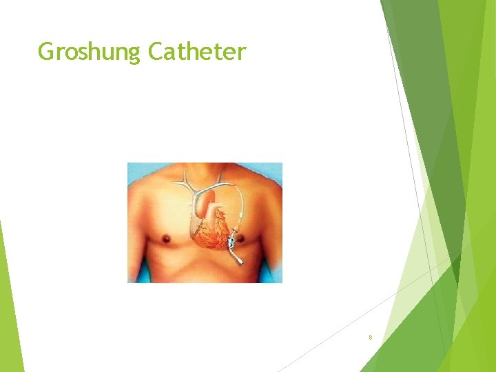 Groshung Catheter 8 