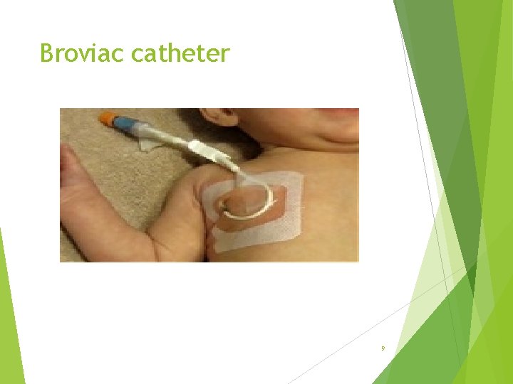Broviac catheter 9 
