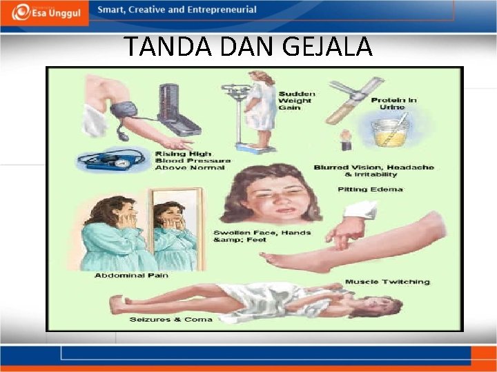 TANDA DAN GEJALA TANDA DAN GEJALA