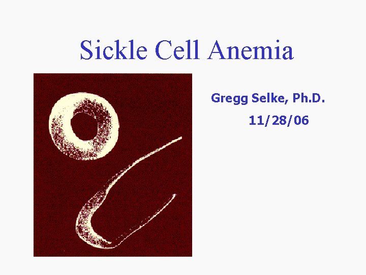 Sickle Cell Anemia Gregg Selke, Ph. D. 11/28/06 