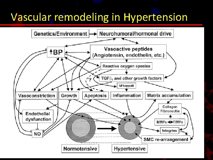 Vascular remodeling in Hypertension 
