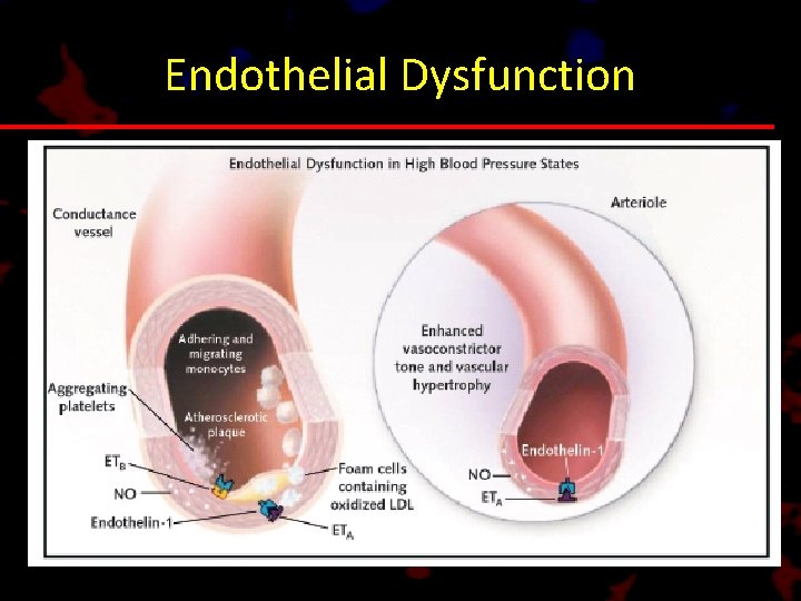 Endothelial Dysfunction 