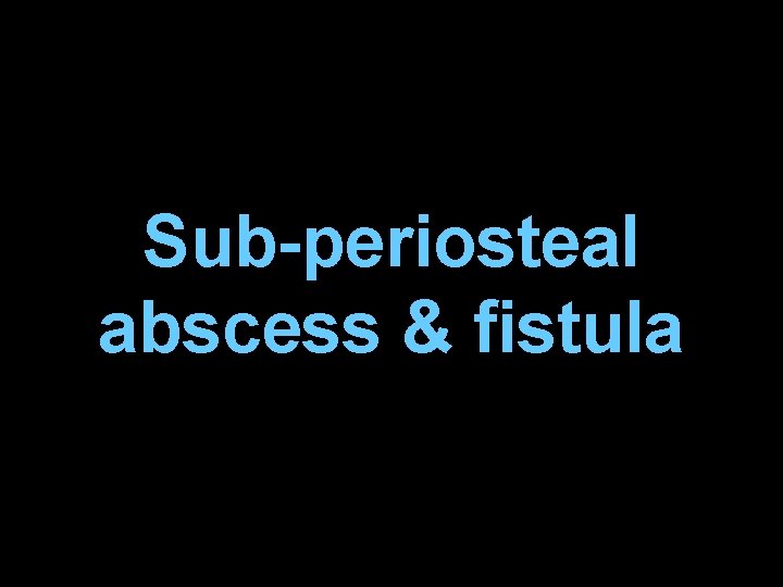 Sub-periosteal abscess & fistula 