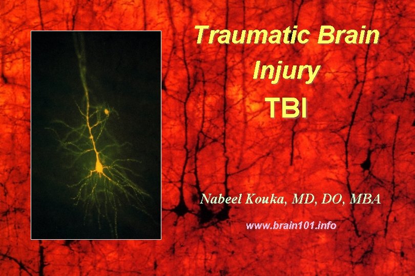 Traumatic Brain Injury TBI Nabeel Kouka, MD, DO, MBA www. brain 101. info 