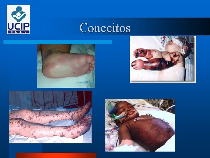 Conceitos 