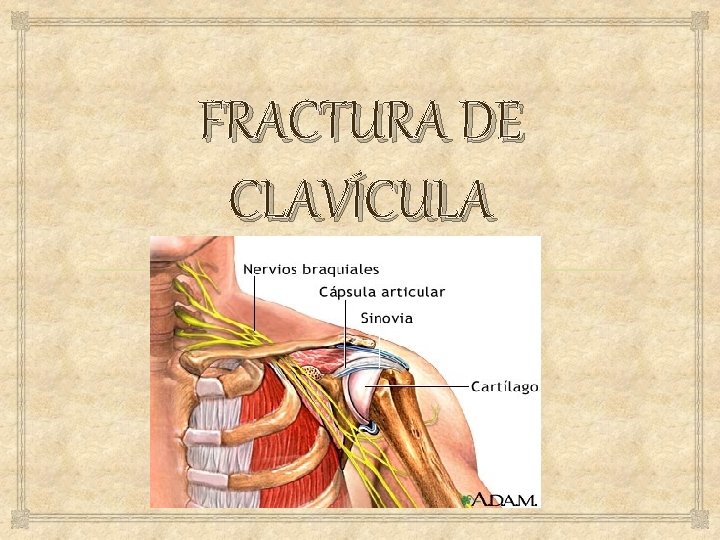 FRACTURA DE CLAVÍCULA 