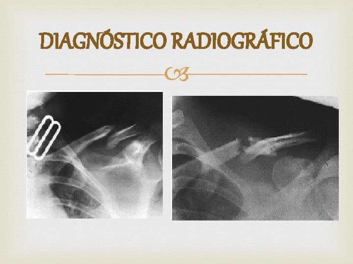 DIAGNÓSTICO RADIOGRÁFICO 