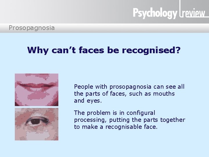 Prosopagnosia Why can’t faces be recognised? People with prosopagnosia can see all the parts