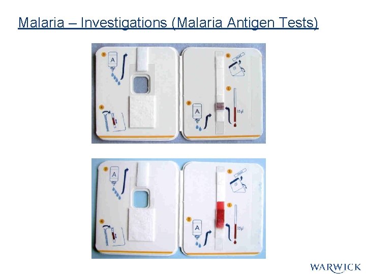 Malaria – Investigations (Malaria Antigen Tests) Malaria – Investigations (Malaria Antigen Tests)
