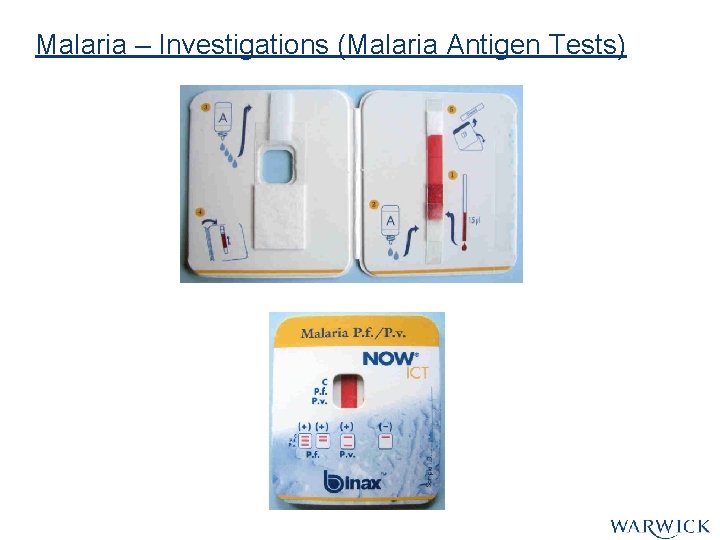 Malaria – Investigations (Malaria Antigen Tests) Malaria – Investigations (Malaria Antigen Tests)