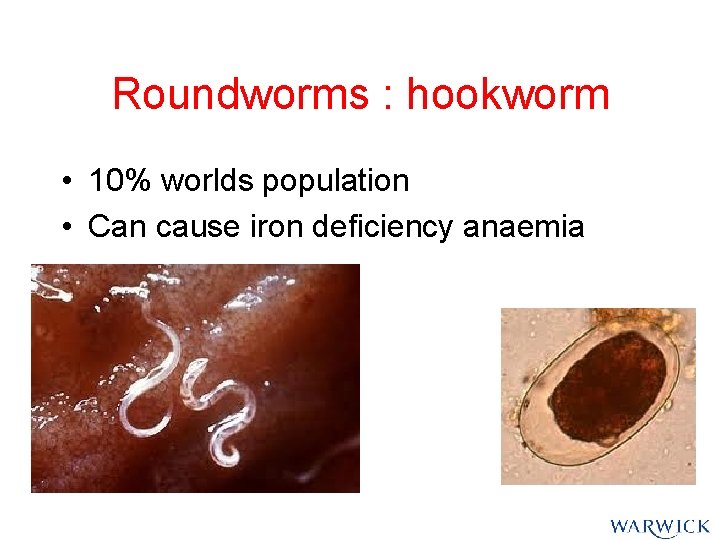 Roundworms : hookworm • 10% worlds population • Can cause iron deficiency anaemia Roundworms : hookworm • 10% worlds population • Can cause iron deficiency anaemia