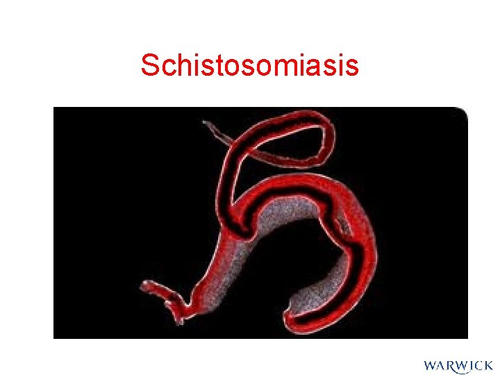 Schistosomiasis Schistosomiasis