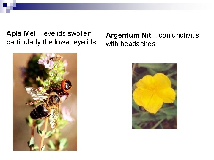 Apis Mel – eyelids swollen particularly the lower eyelids Argentum Nit – conjunctivitis with