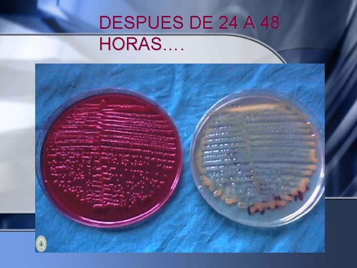 DESPUES DE 24 A 48 HORAS…. 