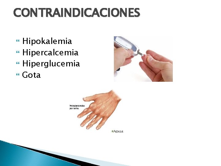 CONTRAINDICACIONES Hipokalemia Hipercalcemia Hiperglucemia Gota 