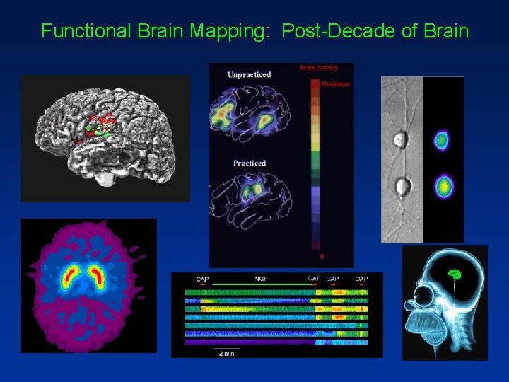 Functional Brain Mapping: Post-Decade of Brain 