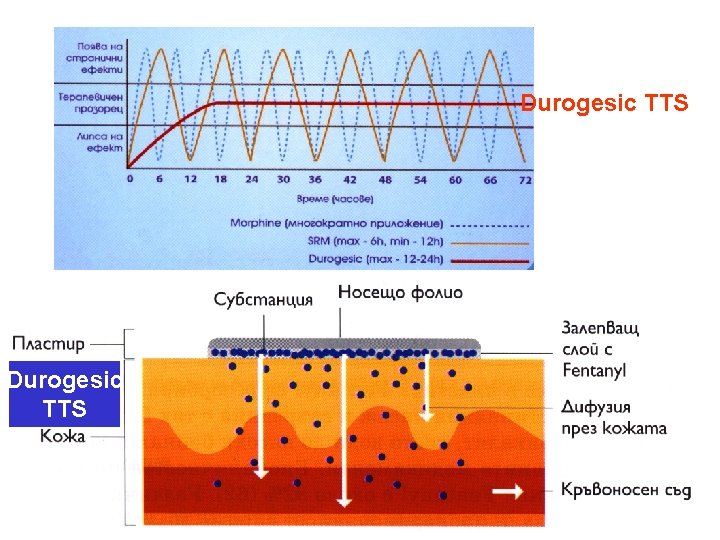 Durogesic TTS 