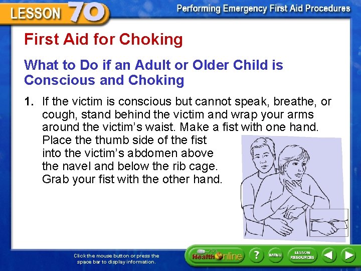 First Aid for Choking What to Do if an Adult or Older Child is