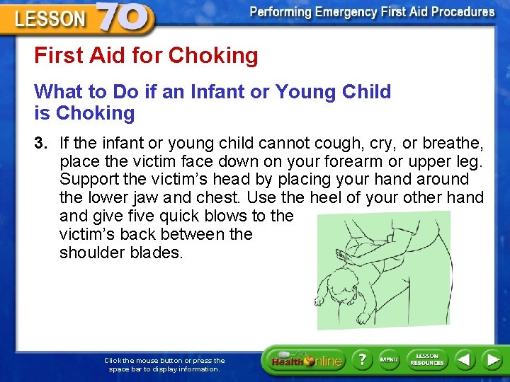 First Aid for Choking What to Do if an Infant or Young Child is