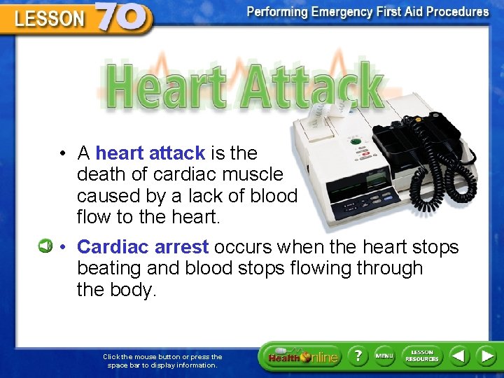 Heart Attack • A heart attack is the death of cardiac muscle caused by