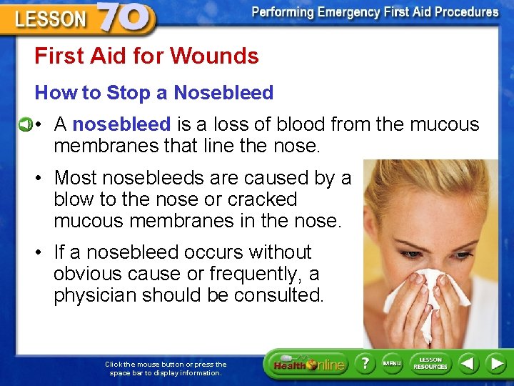 First Aid for Wounds How to Stop a Nosebleed • A nosebleed is a