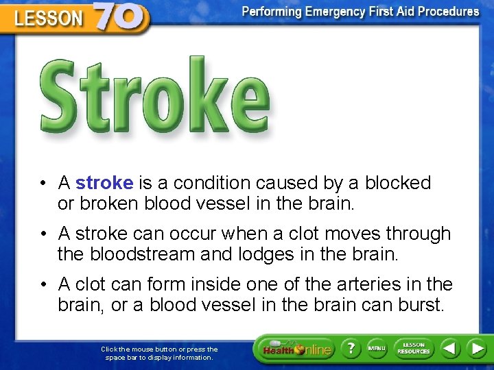 Stroke • A stroke is a condition caused by a blocked or broken blood