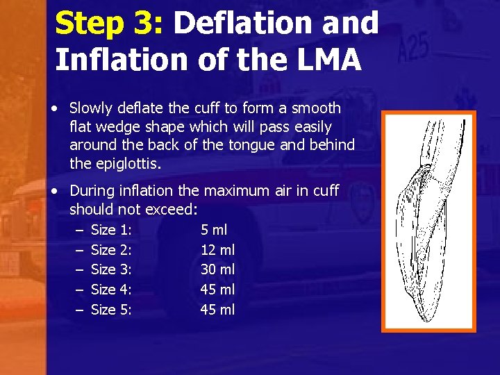 Laryngeal Mask Airways LMA Supreme Indications and Use