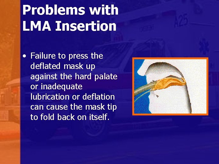 Problems with LMA Insertion • Failure to press the deflated mask up against the