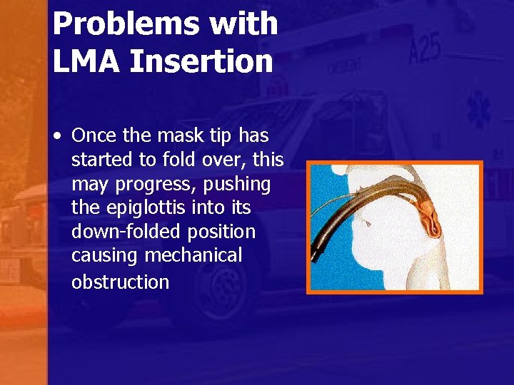 Problems with LMA Insertion • Once the mask tip has started to fold over,