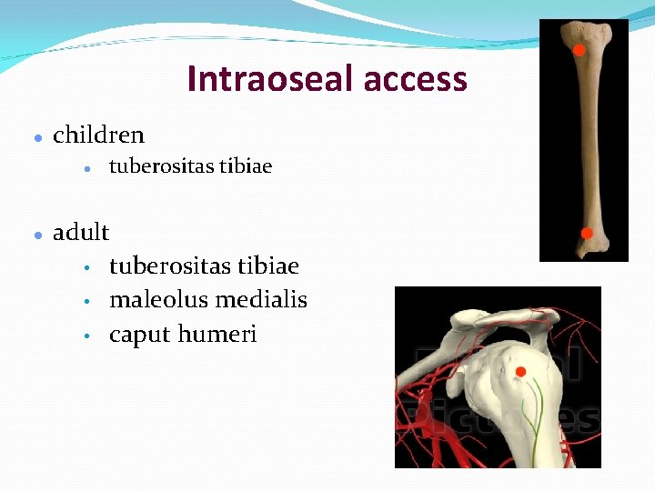 Intraoseal access children tuberositas tibiae adult • tuberositas tibiae • maleolus medialis • caput