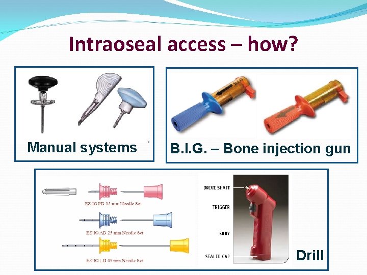 Intraoseal access – how? Manual systems B. I. G. – Bone injection gun Drill