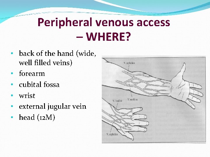 Peripheral venous access – WHERE? • back of the hand (wide, well filled veins)