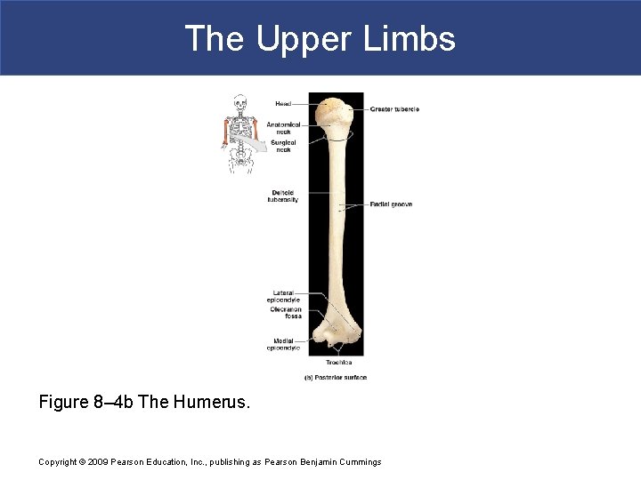 The Upper Limbs Figure 8– 4 b The Humerus. Copyright © 2009 Pearson Education,