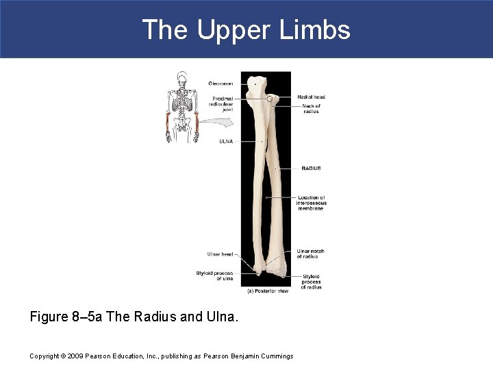 The Upper Limbs Figure 8– 5 a The Radius and Ulna. Copyright © 2009