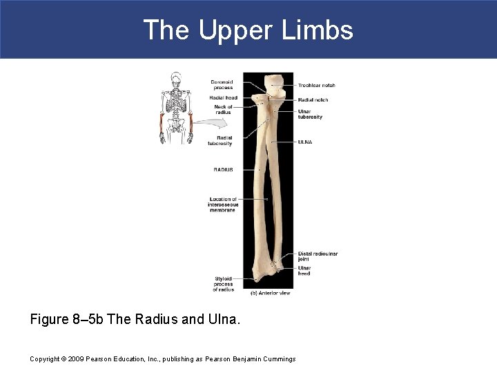 The Upper Limbs Figure 8– 5 b The Radius and Ulna. Copyright © 2009