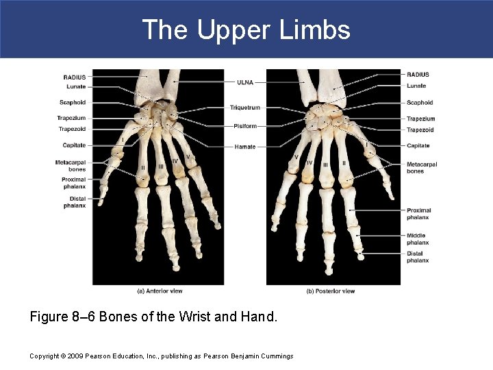 The Upper Limbs Figure 8– 6 Bones of the Wrist and Hand. Copyright ©