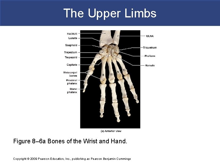 The Upper Limbs Figure 8– 6 a Bones of the Wrist and Hand. Copyright