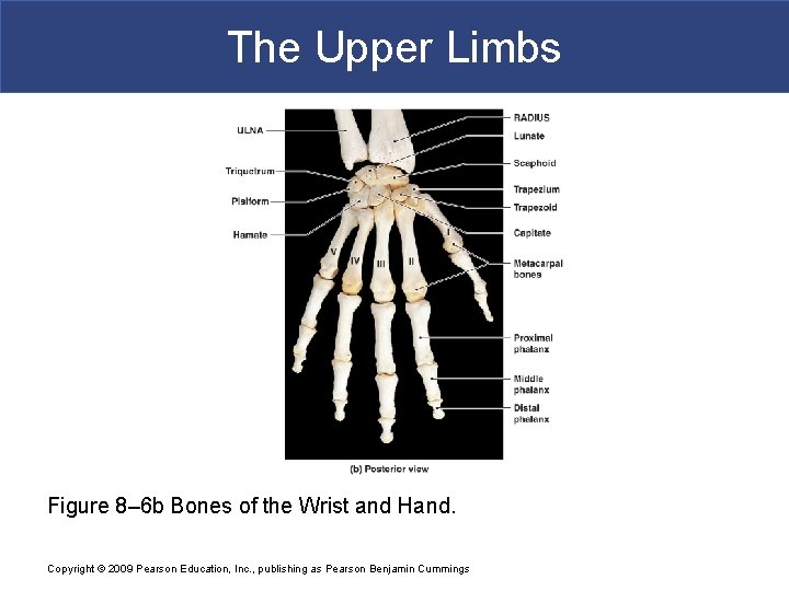 The Upper Limbs Figure 8– 6 b Bones of the Wrist and Hand. Copyright