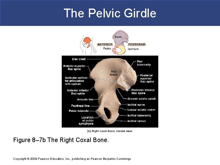 The Pelvic Girdle Figure 8– 7 b The Right Coxal Bone. Copyright © 2009