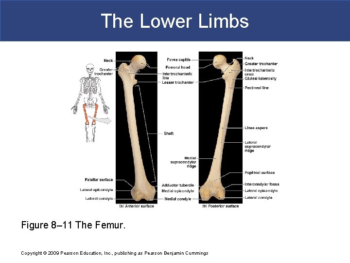 The Lower Limbs Figure 8– 11 The Femur. Copyright © 2009 Pearson Education, Inc.